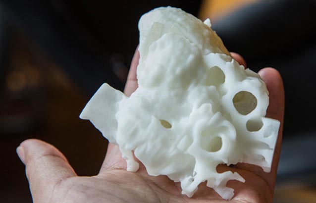 安徽男嬰心臟長五個洞 醫生用3D打印心臟觀察修補