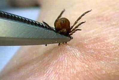 专家提醒:夏季谨防蜱虫叮咬